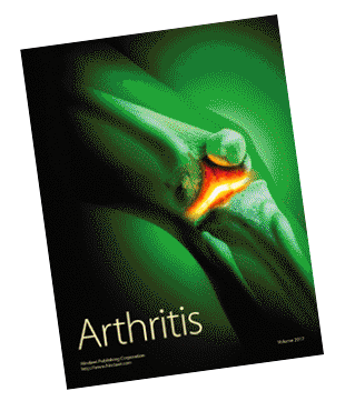 Arthritis Illustration Pain