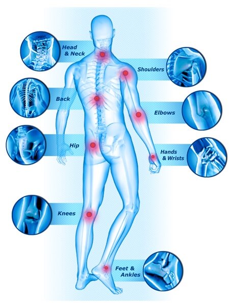 Joint Pain Locations