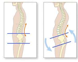 Lose The Back Pain System